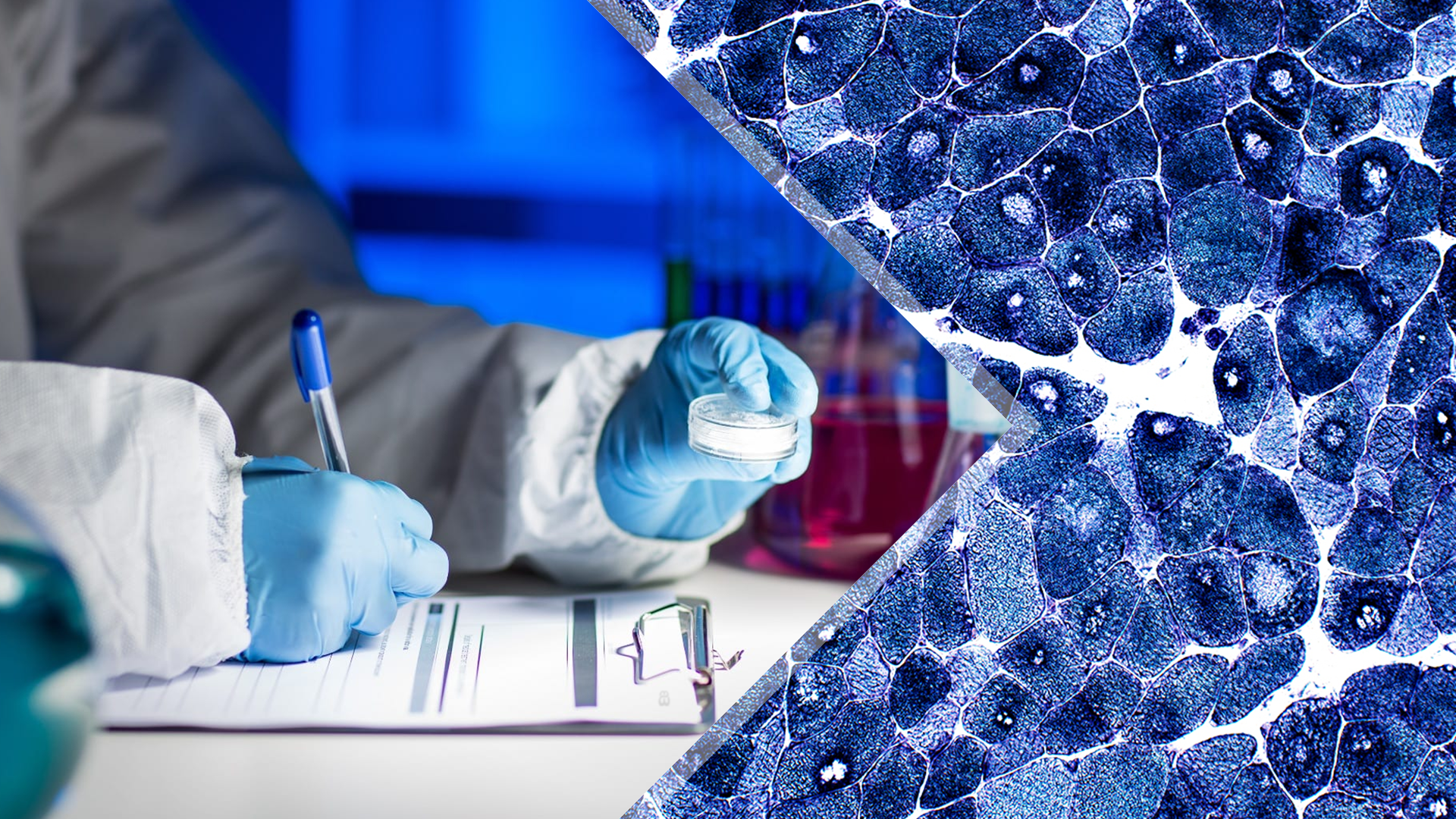 Research and development of innovative technology for botulinum toxin Botoxbio_component_OEM/ODM